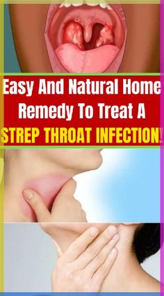 If someone in your house has strep throat, you might get it. But following these tips can help protect you: Sore Throat Remedies For Adults, Strep Throat Remedies, Throat Remedies, Sore Throat Remedies, Yoga Information, Throat Infection, Strep Throat, Natural Antibiotics, Preventative Health