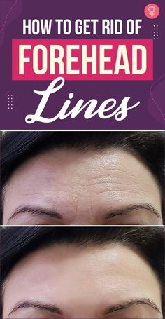 Forehead wrinkles are one of the signs of aging skin. Learn why they occur, how you can prevent them, and some natural remedies to reduce their appearance. Get Rid Of Deep Forehead Wrinkles, Fine Line Remedies, Getting Rid Of Frown Lines, How To Get Rid Of Lines On Forehead, How To Get Rid Of Deep Forehead Wrinkles, How To Get Rid Of Forehead Wrinkles Naturally, 11 Wrinkles How To Get Rid, Dry Forehead Remedies, How To Get Rid Of Lines On Your Neck