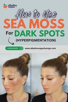 How To Remove Dark Marks From Feet Skin Repair Remedies, Sea Moss Benefits Skin Care, Herbs For Hyperpigmentation, Diy Seamoss Gel, Irish Moss Recipes, Face Moisture, Sea Moss Recipes, Sea Moss Benefits, Hyperpigmentation Serum