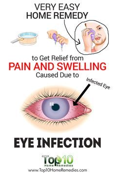 Stye Remedy, Natural Pink Eye Remedy, Eye Stye Remedies, Pinkeye Remedies, Swollen Eyes, Top 10 Home Remedies, Eye Pain, Congestion Relief, Allergy Remedies