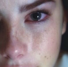 a close up of a woman's face with freckles on her eyes