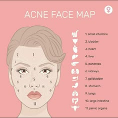 Acne Marks Remedies, Acne Face Map, Face Map, Face Mapping Acne, Skin Facts, Beauty Marks, Skin Advice, Skin Care Routine Order, Face Mapping