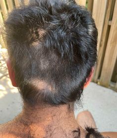 the back of a man's head with frizz on his hair and undercut