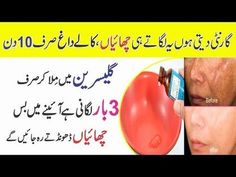 Freckle Remover, Beauty Tips In Urdu, Natural Glowing Skin, Dark Days, Beauty Tips For Skin, Body Pain, Sagging Skin