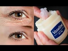 Remove Under Eye Bags, Puffy Eyes Remedy, Wrinkles Remedies Face, Obličejové Masky, Wrinkle Remedies, Under Eye Wrinkles, Remove Dark Circles, Skin Care Wrinkles, Face Wrinkles