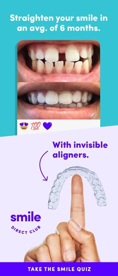 Take the free quiz to see how it works. Get your dream smile with invisible aligners for just $80/mo. Invisible Aligners, Smile Direct, Teeth Straightening, Yoga Beginners, Free Quiz, Gardening Books, Teeth Care, Garden Edging, Diet Keto