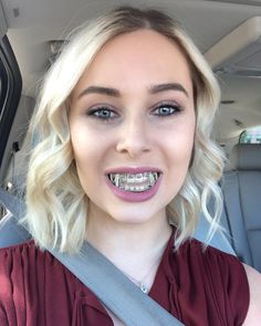 #braces #girlswithbraces #metalbraces #elastics Braces Retainer, Braces And Glasses, Braces Elastics, Cute Girls With Braces, Adult Braces, Metal Braces