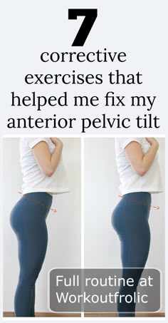 Corrective Exercises, Fitness Before After, Anterior Pelvic Tilt, Fix Your Posture, Correct Posture, Pelvic Tilt, Posture Exercises, Fitness Home