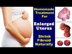 Enlarged Uterus, Fennel Seeds, Home Remedies, Natural Remedies, Education, Health