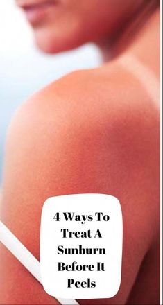 Say Goodbye To Sunburn Peeling Forever!Say Goodbye To Sunburn Peeling Forever! Sunburn Peeling, Bad Sunburn, Natural Face Care, Perfect Skin Care Routine, Peeling Skin