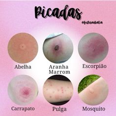 the different types of acne in spanish