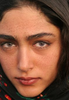 a woman with freckles on her head and scarf around her neck looking at the camera