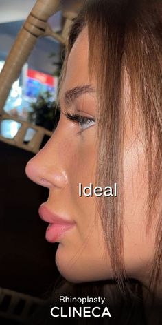 Types Of Noses Side Profile, Perfect Button Nose, Nose Job Inspo Front View, Ideal Nose Rhinoplasty, Cindy Kimberly Side Profile, Perfect Nose Side Profile, Beautiful Nose Shape