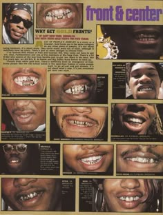 an advertisement for teeth and gums with pictures of people's mouths in them