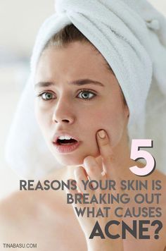 Acne is a skin condition that affects almost everyone at some point in life. It’s important to understand what causes acne to tackle it better. Here are 6 reasons.. your skin might be breaking out. How To Stop Breaking Out On Face, What Causes Acne, Back Pimples, Face Breaking Out, Skin Breaking Out