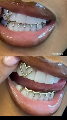 grills, gold grills inspo, gold grills girls Piercing Needle Aesthetic, 2 Piece Grillz, Gold Grills Women, Gold Grillz For Females, Single Grillz Teeth, Grill Inspo Girl, Gold Jewellery Black Women, Gold Teeth Aesthetic, Gold Piercings Aesthetic