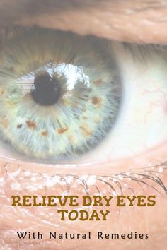 Simple and effective ways to curing and preventing dry eyes. Natural remedies for dry eyes help to overcome the painful, irritable sensation Remedies For Dry Mouth, Pinkeye Remedies, Home Remedies For Allergies, Home Remedies For Warts, Warts Remedy, Dry Eyes Relief, Dry Skin Remedies