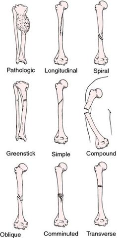 the different bones and their functions are shown in this diagram, which shows how they look like