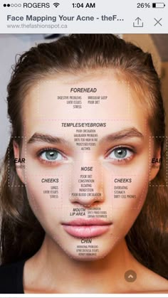 What are your face breakouts telling you?! Face mapping on what pimples on your face means. Gesicht Mapping, Face Map, Face Mapping Acne, Motivasi Diet, Face Mapping, Face Acne, Acne Remedies, Skin Tips, Facial Care