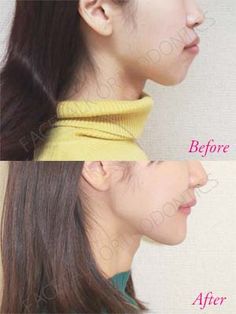 Jawline Exercise, Double Chin Exercises, Chin Exercises, Face Yoga Facial Exercises, Beauty Makeup Tutorial, Health And Fitness Magazine, Face Exercises, Quick Workout Routine, Facial Exercises