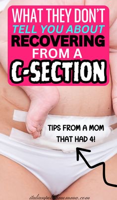 C section recovery tips and c section recovery must-haves, what to do before your c-section, post c-section care, c-section recovery essentials Pregnancy After C Section, C Section Recovery Kit, C Section Recovery Essentials, C Section Belly