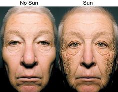 Safety App, Aesthetic Medicine, Sun Tattoos, Face Wrinkles, Sun Tattoo, Skin Care Solutions, Truck Driver, Esthetician, Damaged Skin