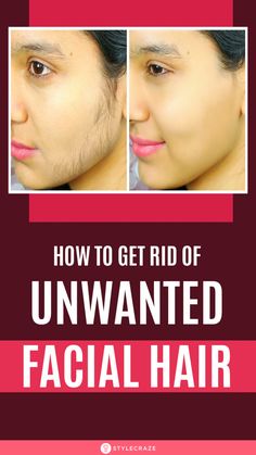 Are you suffering from unwanted facial hair? Then, your wait is over. Click here to learn how to get rid of facial hair with simple and effective home remedies. Hair On Face Women, Getting Rid Of Facial Hair For Women, Get Rid Of Facial Hair Permanently, Home Remedy To Remove Facial Hair, Natural Facial Hair Removal For Women, How To Reduce Facial Hair, Facial Hair Removal For Women Permanent, Waxing Face Tips Facial Hair, How To Get Rid Of Facial Hair On Women