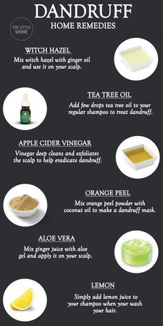 Alovera For Dandruff, How To Get Rid Of Hair Dandruff, How To Deal With Dandruff Dry Scalp, Dandruff Remedy Diy How To Get Rid, What Helps With Dandruff, Causes Of Dandruff, Instant Dandruff Removal, Natural Ways To Get Rid Of Dandruff, How To Clear Dandruff