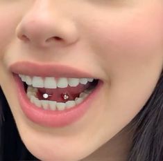 a woman with braces on her teeth smiles at the camera