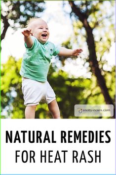 Natural Remedies for Heat Rash (Prickly Heat) in Kids. Don't Let heat rash ruin your summer! #parenting #healthykids #kidshealth #kidsrashes #naturalremedies