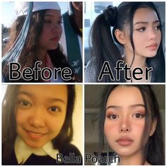 #plasticsurgery #plasticsurgerygonewrong #beforeafter #celebritiesbeforeafter #hollywoodstars #bignosesurgery #surgery #facesurgery #vlinesurgery #koreanplasticsurgery #kpopplasticsurgery #nosejob #jawreductionsurgery #eyesurgery #cheekfillers #rhinoplasty #facelift #plasticsurgeryfails #expensiveplasticsurgery #viral Subliminal Results Hair, Subliminal Results, Vacation Hacks, V Line Surgery, Horrible Tattoos, Master Tattoo