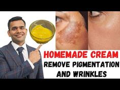 Water At Night, Diy Wrinkles, Welcome To My Youtube Channel, Diy Cream, Dark Spots On Face, Water In The Morning, Skin Pigmentation, Doctor Advice, Skin Natural Remedies