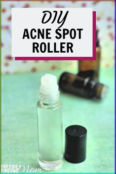 Got a blemish that just won't go away? Try this homemade acne spot treatment (best for all skin types)! This easy all-natural DIY acne treatment requires only six ingredients (witch hazel, Vitamin E oil, and lavender, tea tree, clary sage and juniper berry essential oils) and can be whipped up in minutes! #acnetreatment #acneskincareroutine #homemadeacneremedies #diyacnetreatment Juniper Berry Essential Oil, Forehead Acne, Acne Skincare Routine, Natural Acne Remedies, Natural Acne, Lavender Tea, Acne Spots, Juniper Berry