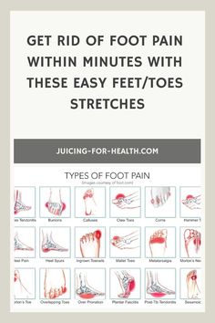 Get Rid Of Foot Pain Within Minutes With These Easy Feet/Toes Stretches Foot Pain Chart, Foot Stretches, Leg Bones, Juicing For Health, Live Healthy, Heel Pain, Foot Pain, Book Humor, Body And Soul