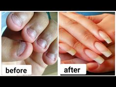 How to:Grow Nails Faster & Strong at home/ Grow bitten Nails - YouTube Long Nail Beds, Split Nails, Grow Nails Faster, Tropical Vacation Nails, Natural Nail Art, Minimalist Nail Art, How To Grow Nails