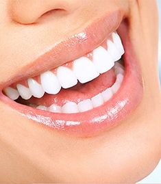 Teeth Whitening Dentist, Teeth Whitening Procedure, Dental Implants Cost, Smile Makeover, Best Teeth Whitening, Dental Cosmetics