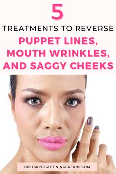 Get Rid Of Marionette Lines, Saggy Cheeks, Wrinkles Remedies, Crepe Skin, Mouth Wrinkles, Marionette Lines, Saggy Skin, Natural Remedy