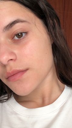 Acne Aesthetic, Basic Skin Care Routine, Clear Face, Vogue Beauty, Bare Face, Normal Skin, Aesthetic Beauty, Pale Skin, Glass Skin