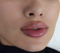 Lip Fillers Juvederm, Face Fillers, Botox Lips, Cheek Fillers, Facial Fillers, Facial Aesthetics, Lip Filler, Botox Fillers