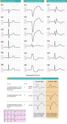 Cardiac Electrophysiology, Cvicu Nurse, Medical Pins, Medical School Life