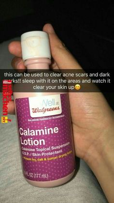 xbrattt 🥀🥵 Obličejové Masky, Calamine Lotion, Acne Scar, Clear Acne, Health And Beauty Tips, Skin Tips, Facial Care, Hair Skin, Skin Treatments