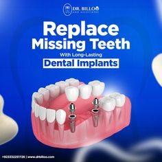 #SocialMediaPost #SocialMediaPostDesign #SocialMediaMarketing #Dentist #Clinic #Dentistpost #DentistSocialMediaPost Dental Mouthguards