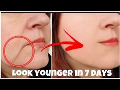 Get Rid of Laugh Lines, Jowls , Sagging Cheeks with Facial Exercises| Rachna Jintaa - YouTube Jowls Sagging, Get Rid Of Laugh Lines, Jowl Exercises, Facial Exercises For Jowls, Sagging Jowls, Jaw Exercises, Face Lift Exercises, Sagging Cheeks, Jawline Exercise