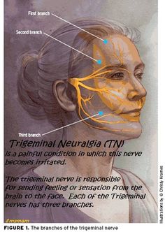 Facial Anatomy, Dental Anatomy, Facial Nerve, Cranial Nerves, Medical Anatomy