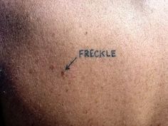 the back of a man's neck with an arrow and word freckle written on it