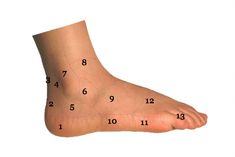 Sol Foot & Ankle Centers specializes in a wide array of foot and ankle conditions and surgery. Get relief for your foot and ankle pain in Long Beach, CA Foot Pain Chart, Lisfranc Injury, Ankle Pain Relief, Ankle Fracture, Calf Cramps, Ankle Pain, Nerve Pain Relief, Juice Diet