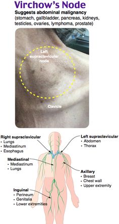 an image of the back and side of a man's neck with labels on it