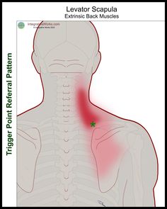 Stiff Side of Neck When Turning - Integrative Works Therapy Notes, Neck Pain Relief, Pain Relief