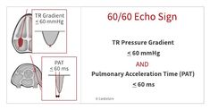 the instructions for how to use an echo sign in order to read and understand it