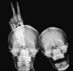 an x - ray image of two human skulls with the words damn it, carl